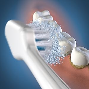 Using STRB-3WW Waterpik White Triple Sonic Brush Heads, STRB-3WW