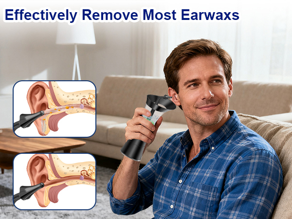 ear wax removal tool