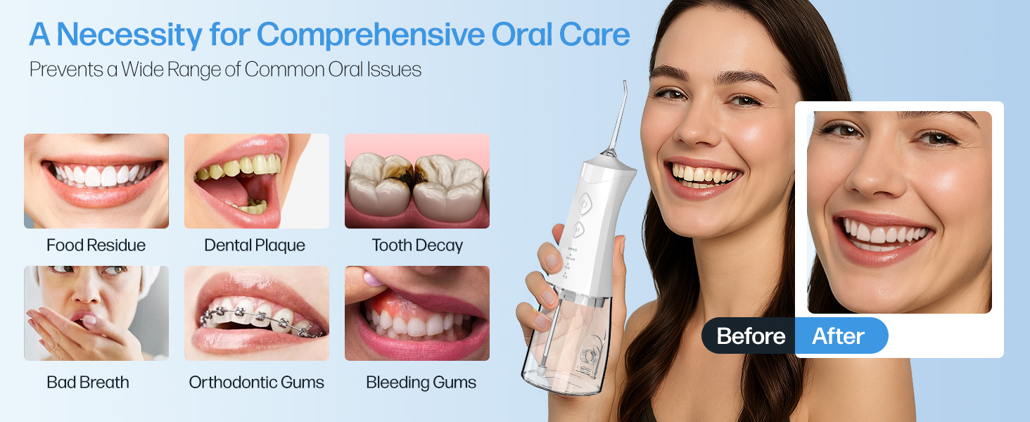 Water Dental Flosser Cordless for Teeth