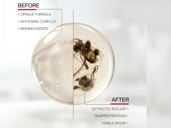 Hismile iD Stain Whitening Mouthwash, Gunk Removing Mouthwash 