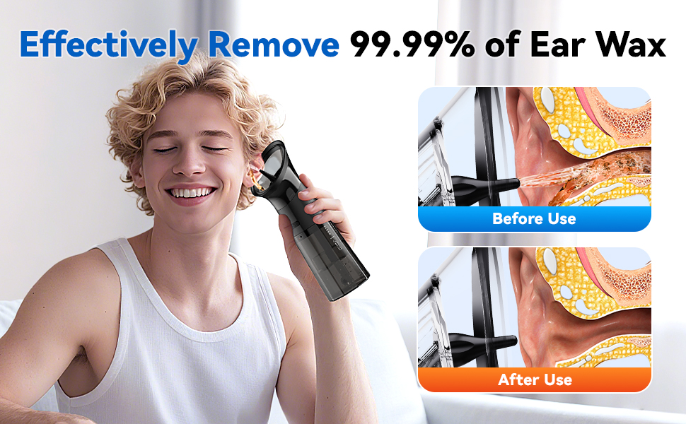 Electric Ear Wax