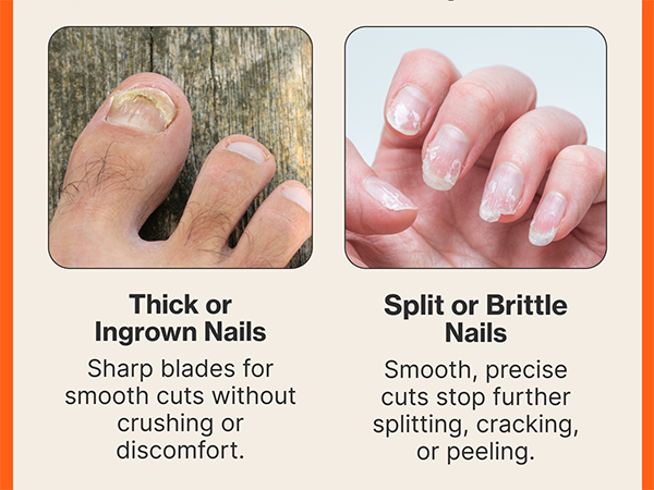 Nail Clippers for Seniors