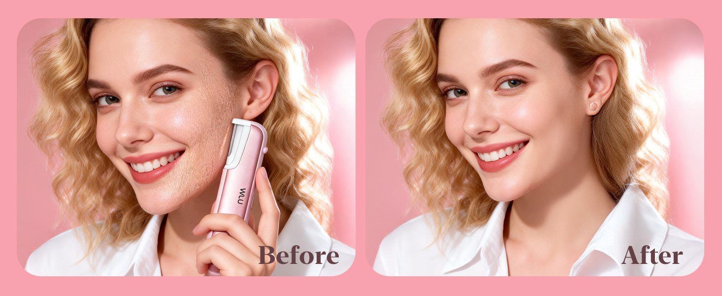 Dermaplane Razor