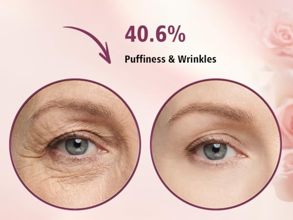 Puffiness &amp; Wrinkles