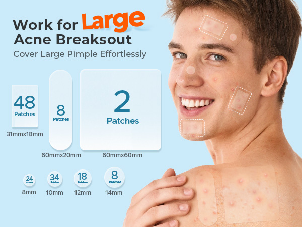 large pimple patches