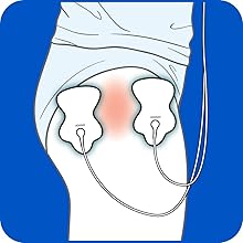 Omron TENS Pads
