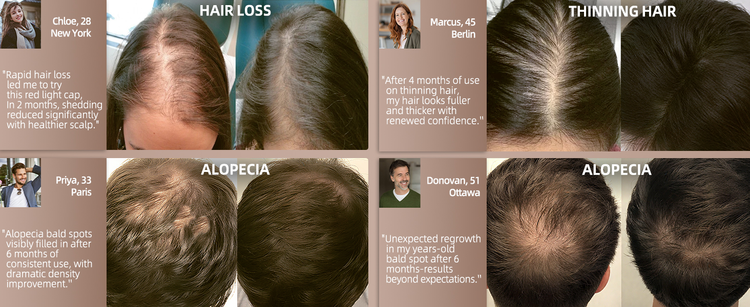 Rapid hair loss