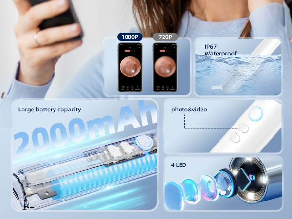 otoscope ear camera