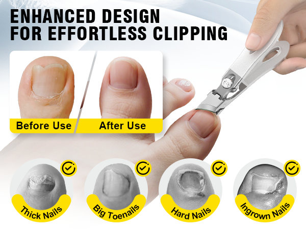 toenails clippers