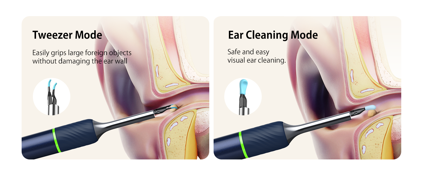 Ear Tweezers &amp;amp;amp; Ear Spoon