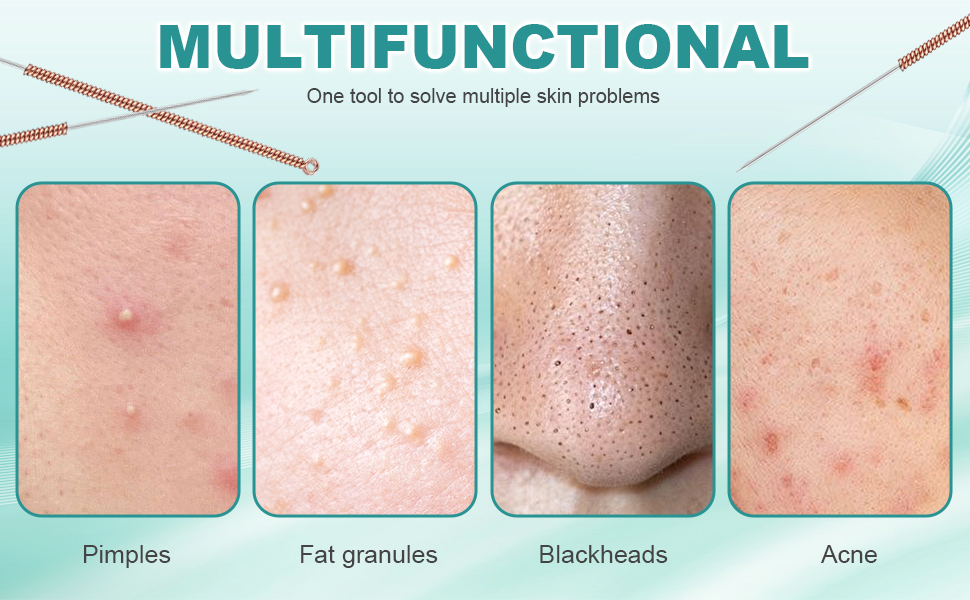 Optimized text: Disposable acne needle set — for blackheads, blemishes, and zits