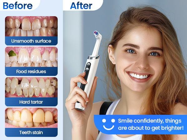 teeth stain remover