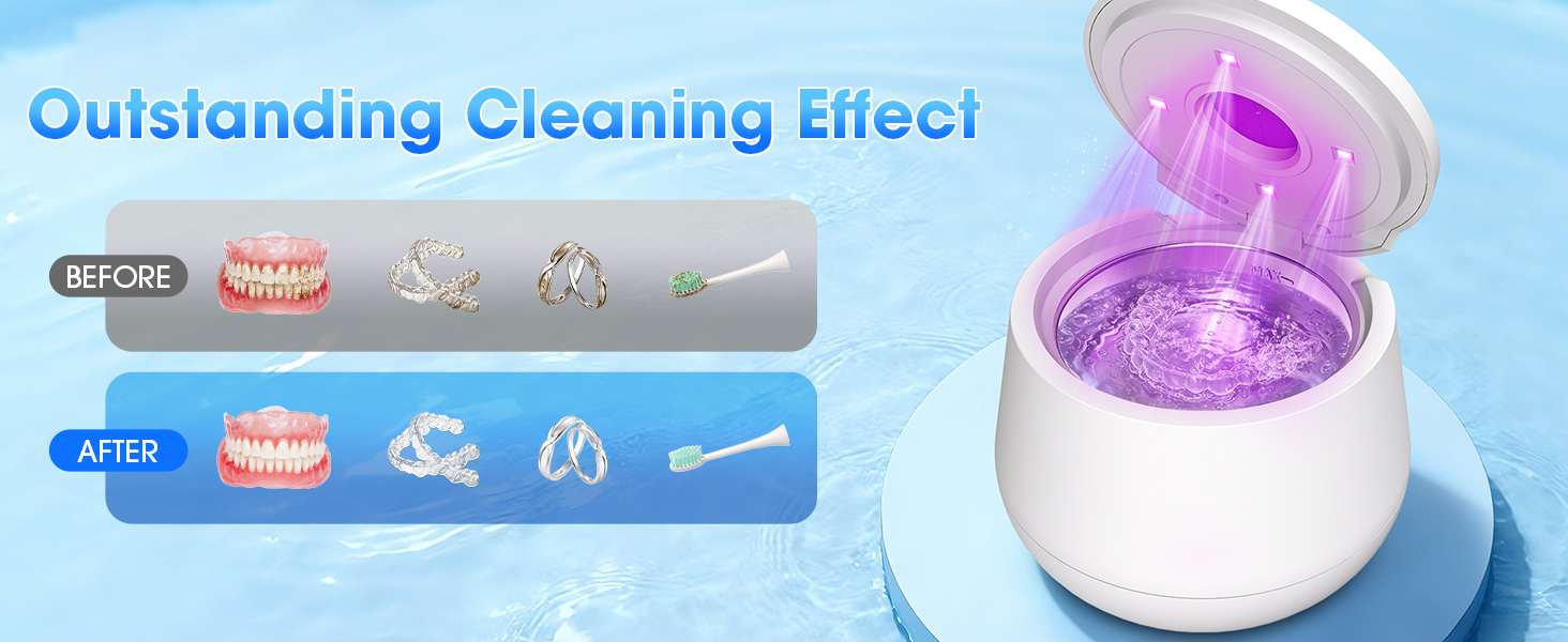 Ultrasonic Retainer Cleaner