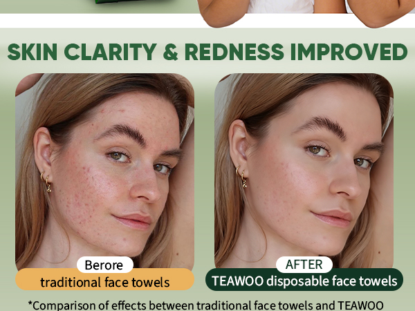 SKIN CLARITY &amp; REDNESS IMPROVED