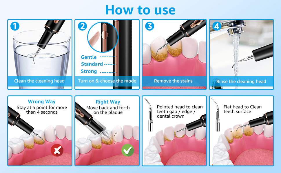 Teeth Cleaning Kit Plaque Remover for Teeth, Portable Ultrasonic Tooth Cleaner Plaque Remover