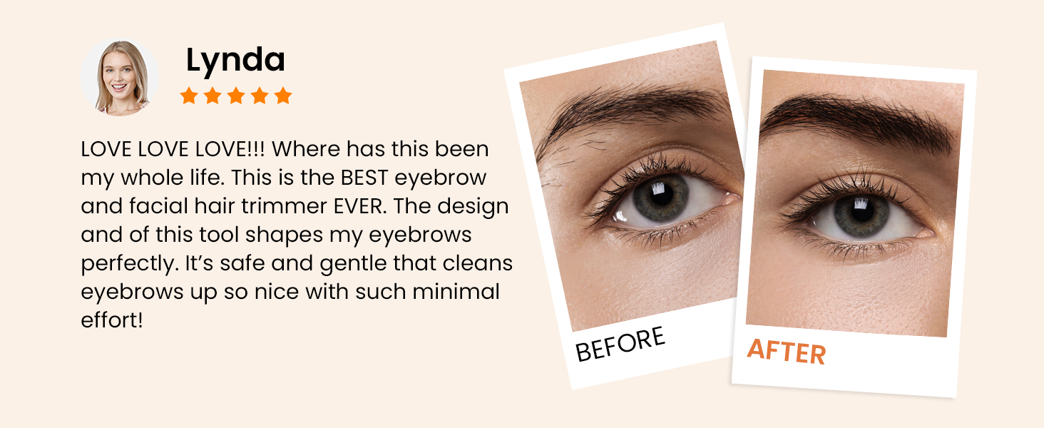 A10 REVIEW1-facial hair remover for women face