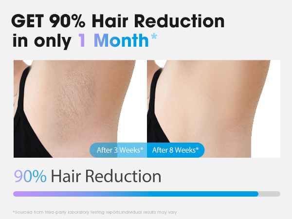 laser hair removal for women