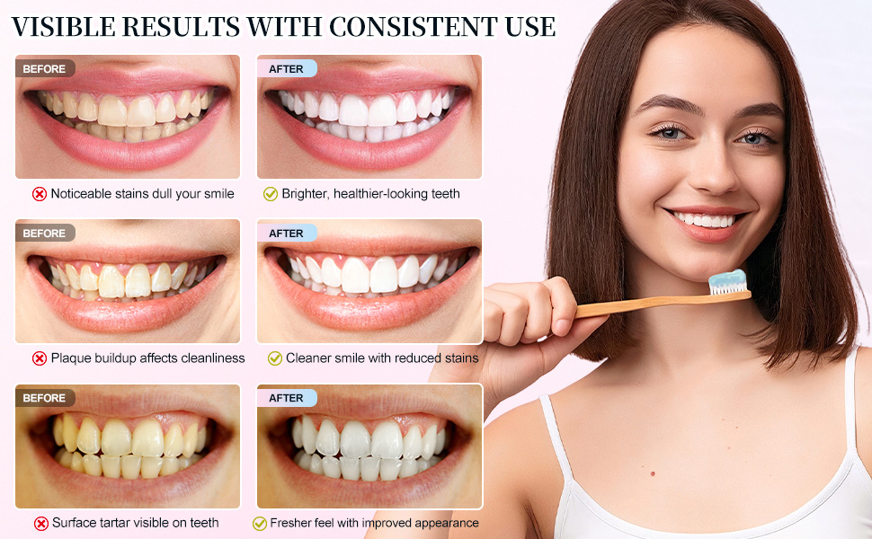 Whitening Toothpaste
