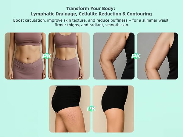 cupping therapy massager