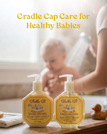 Craddle Cap Treatment