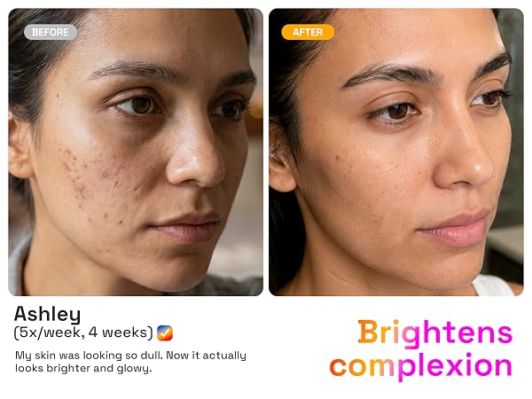 Brightens complexion
