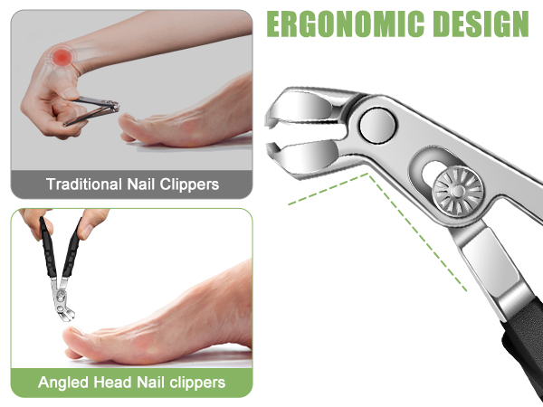TOENAIL CLIPPERS