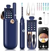 Loyker Ear Wax Removal, Ear Cleaner with 1080P Camera, Ear Cleaning Kit with 12 Ear Pick, Visual ...