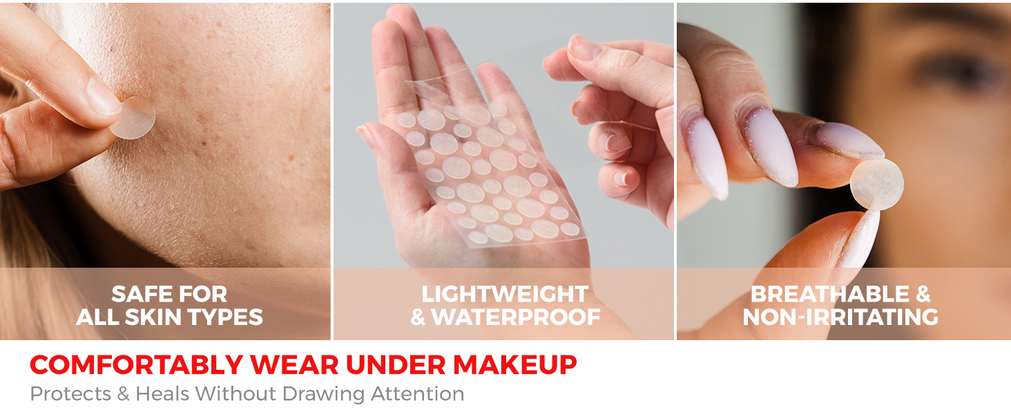 pimple patches, acne patches, pimple patches for face