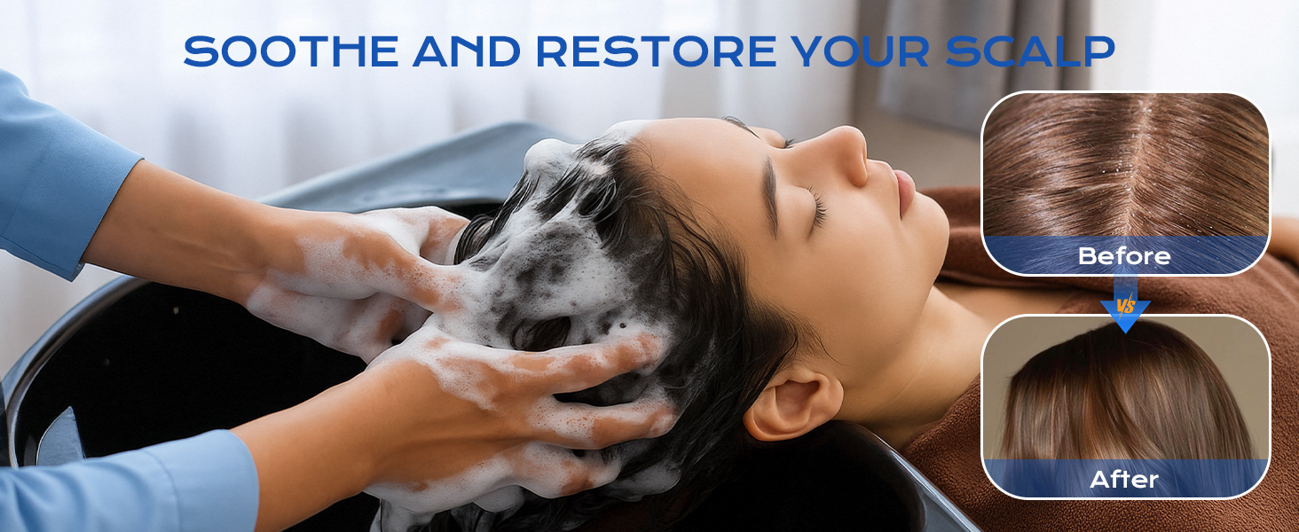 Anti-Fungal Shampoo