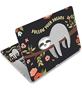 ARTSO 12 13 14 15 15.4 15.6 Inches Laptop Skin Sticker Decal Universal Netbook Skin Sticker Reusa...