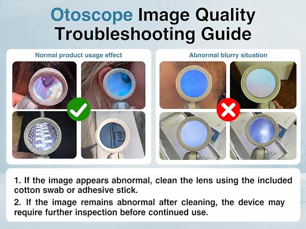 otoscope