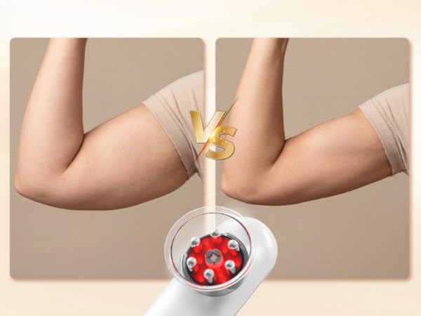 Body Sculpting Lymphatic Drainage