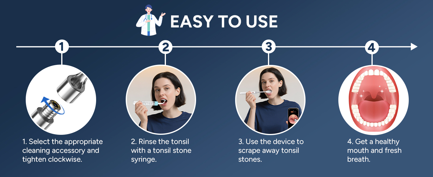 Tonsil Stone Remover with Camera