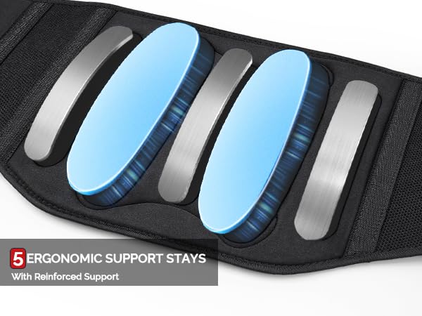 strong support stays