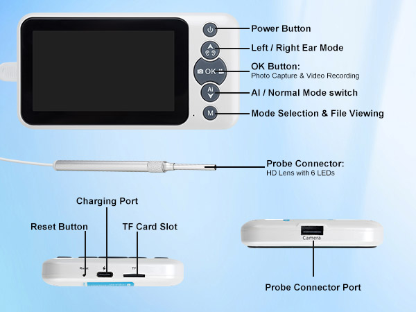 Handheld earscope buttons for photo, video, file viewing and AI mode switch.