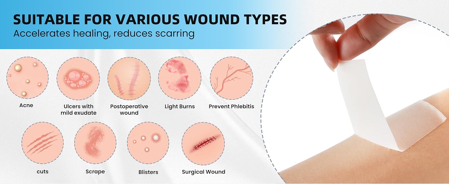 hydrocolloid roll for acne