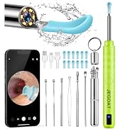 Ear Wax Removal Tool Camera, Ear Cleaner with Camera, Ear Cleaning Kit 1296P HD Ear Scope, 6 LED ...
