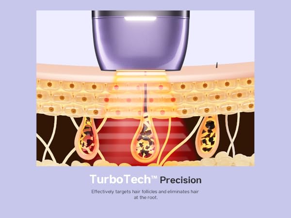 laser hair removal device