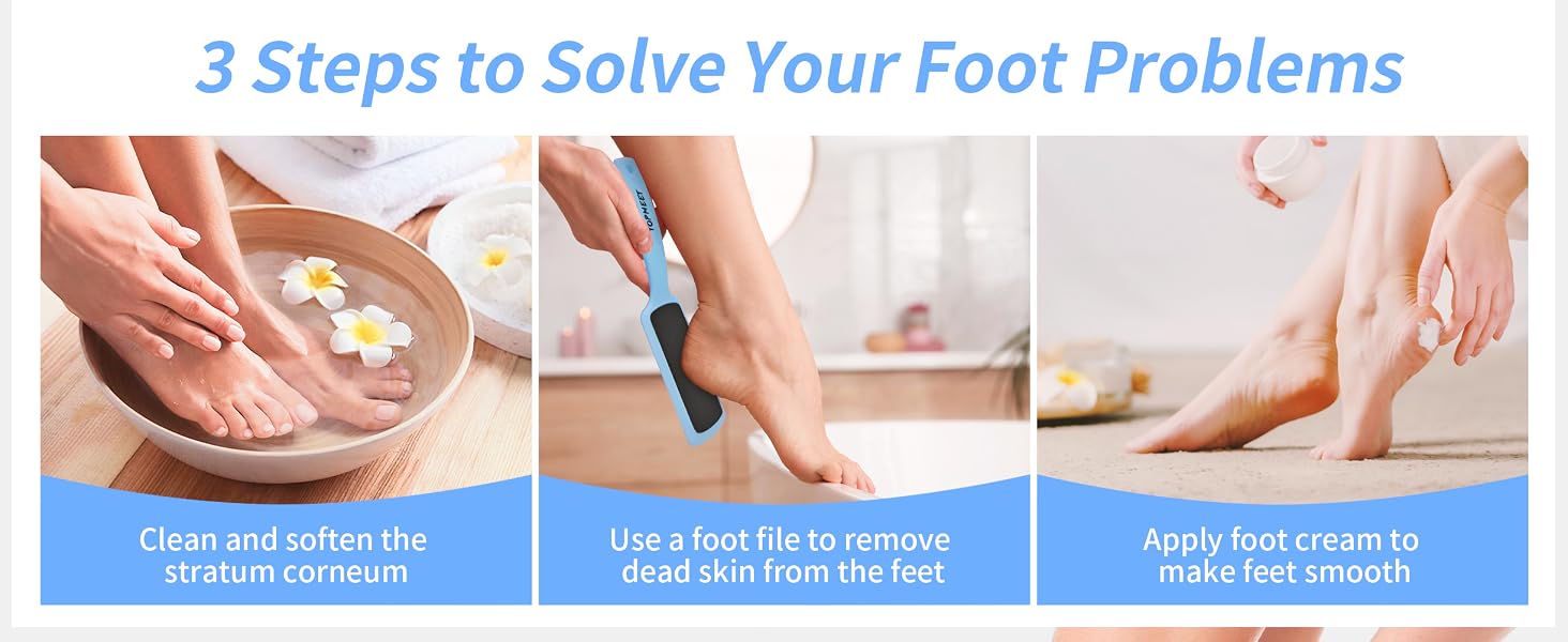 Foot File for Dead Skin