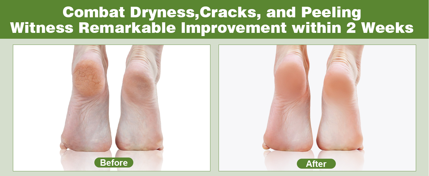 WITNESS REMARKABLE IMPROVEMENT