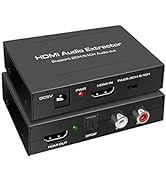 LVY HDMI Audio Extractor, 4K HDMI to HDMI + Audio (SPDIF + RCA Stereo) Audio Extractor Supports A...
