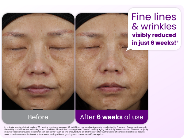 Fine lines and wrinkles visibly reduced in just 6 weeks
