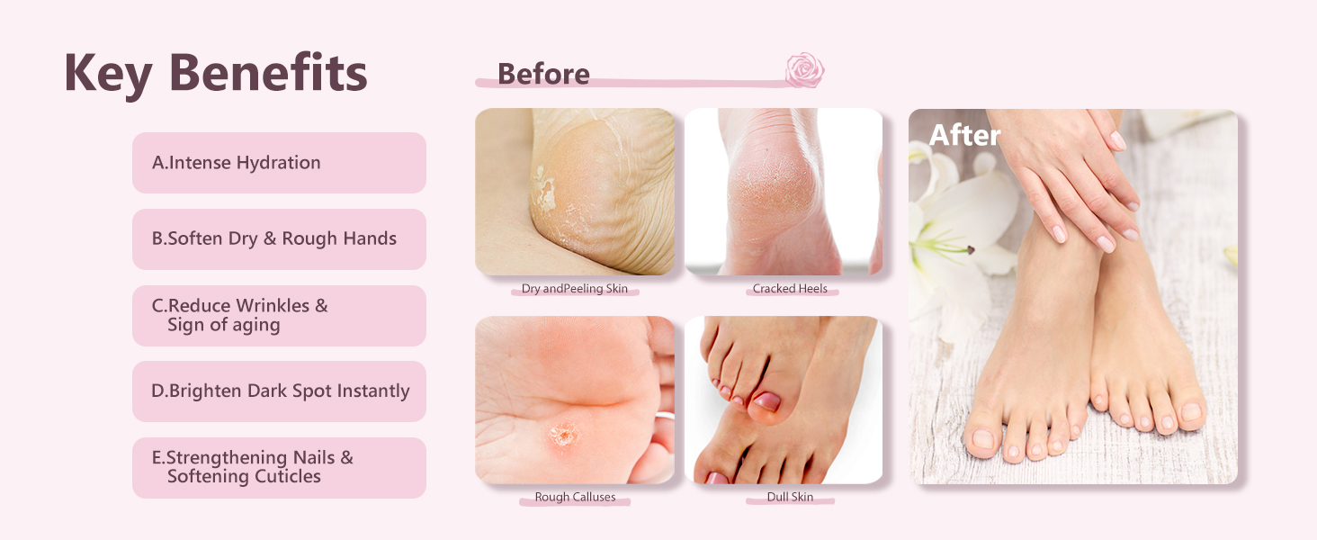 Moisturizer Sock for Dry Cracked Feet Heel