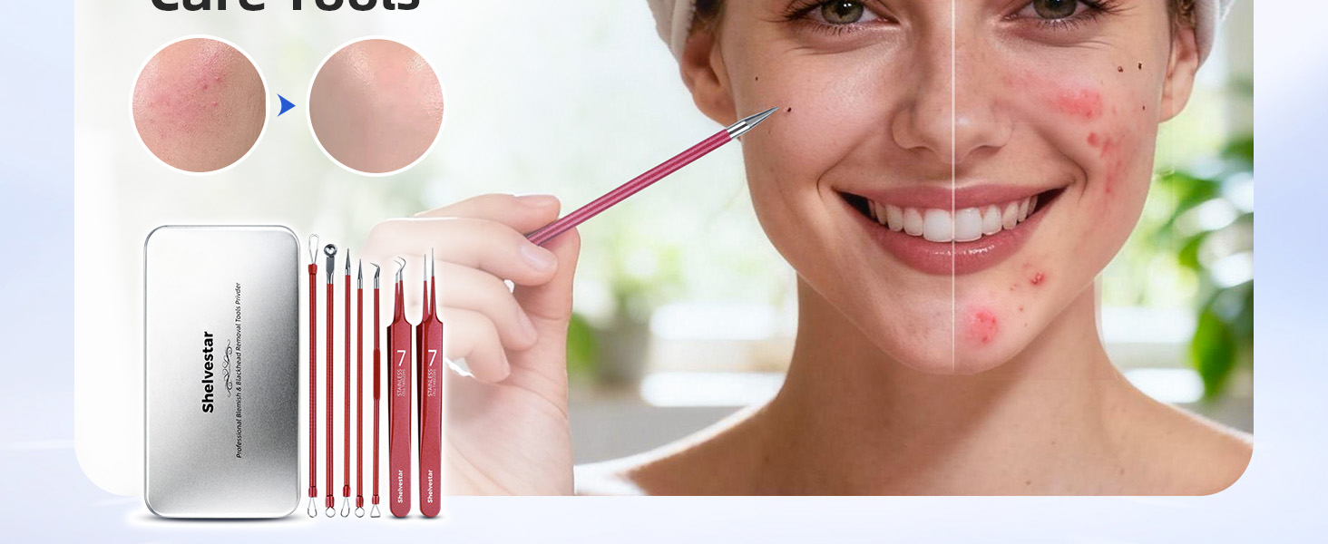 Pimple Popper Tool, Blackhead Remover Acne and Zit Comedone Extractor Kit