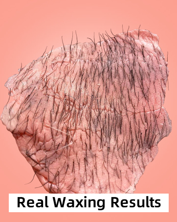 EFFECTIVE HAIR REMOVAL RESULT