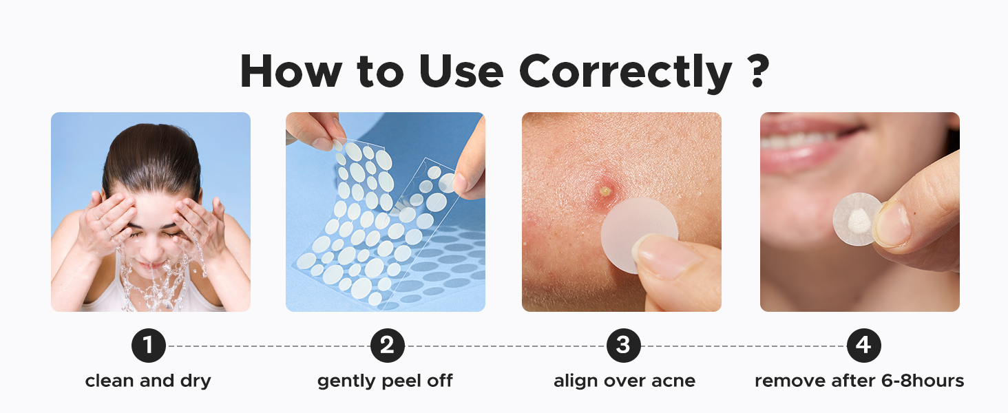 acne pimple patches for face