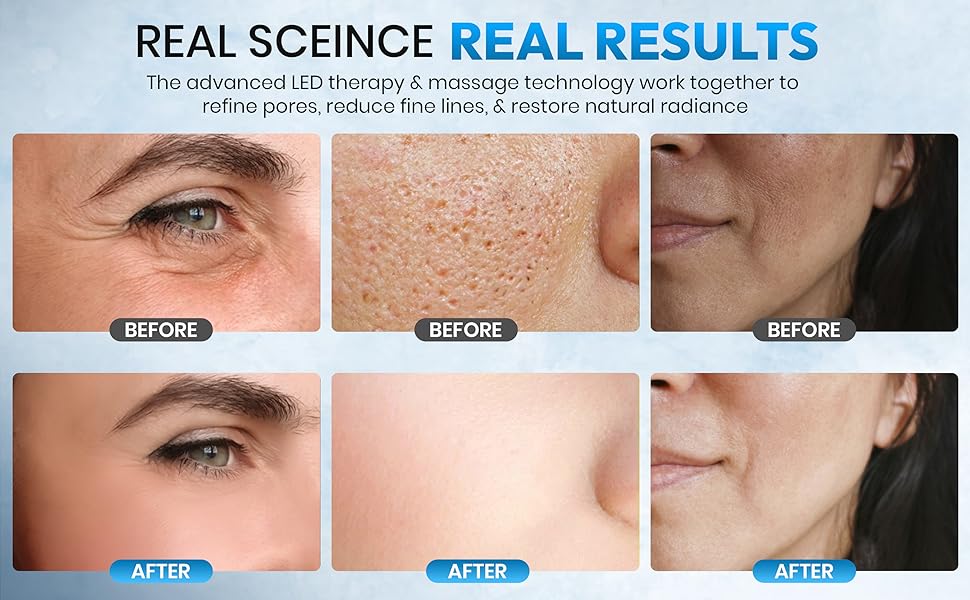 LED facial device for smoother, youthful looking skin