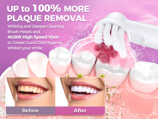 Rotating Electric Toothbrush