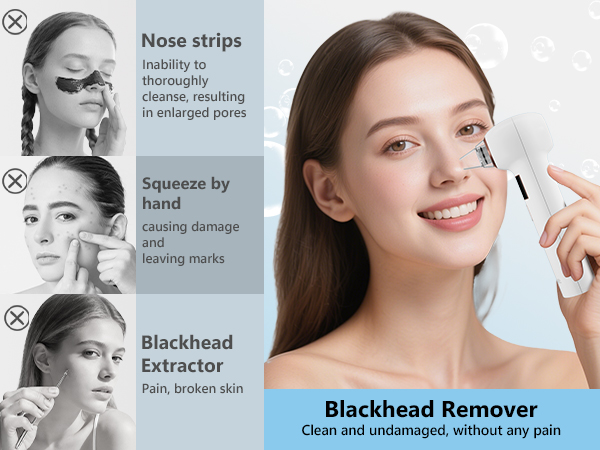 Blackhead Remover