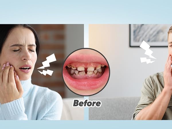 dental polisher